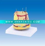 Wholesale Pathological acne model